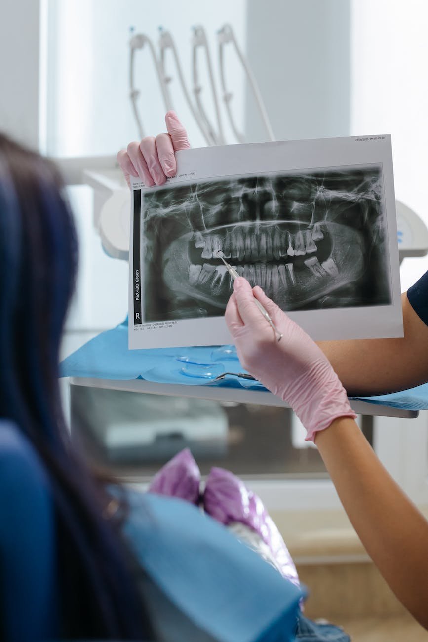 Take Care of Your Teeth
