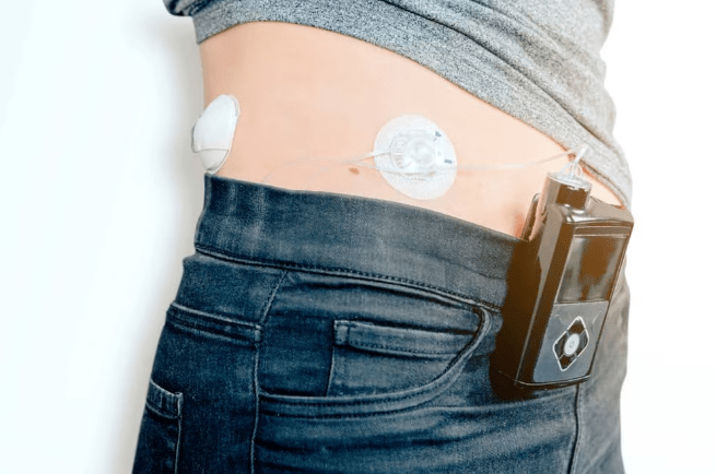 A Cure for Type 1 Diabetes: New Breakthroughs & Hope for US