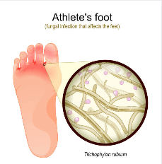 Causes and Risk Factors