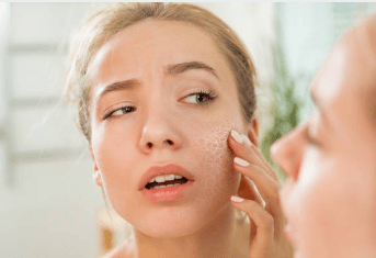Dealing With Dry Skin