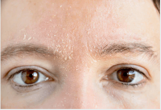 Aditional Considerations