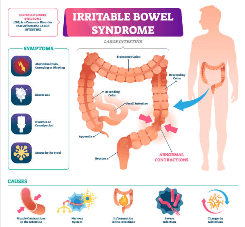 Irritable Bowel Syndrome