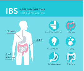 Irritable Bowel Syndrome